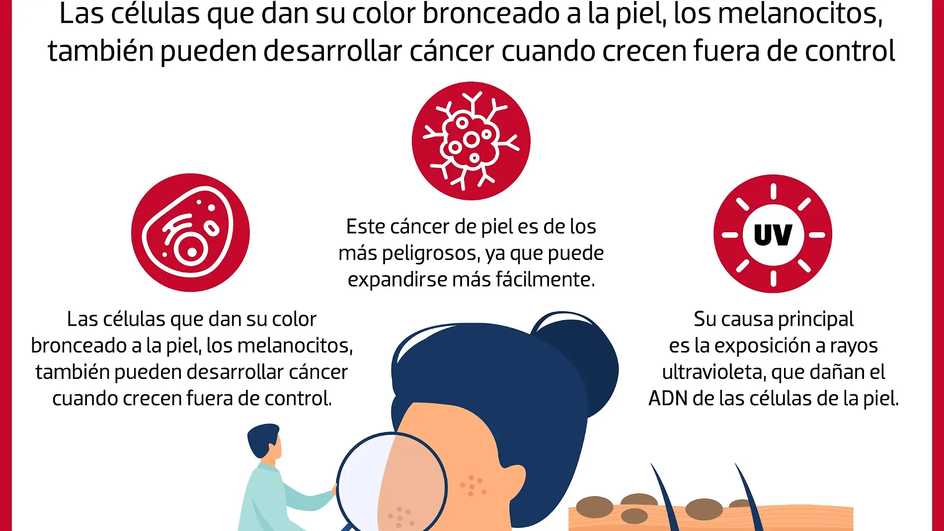 Infografía Melanoma